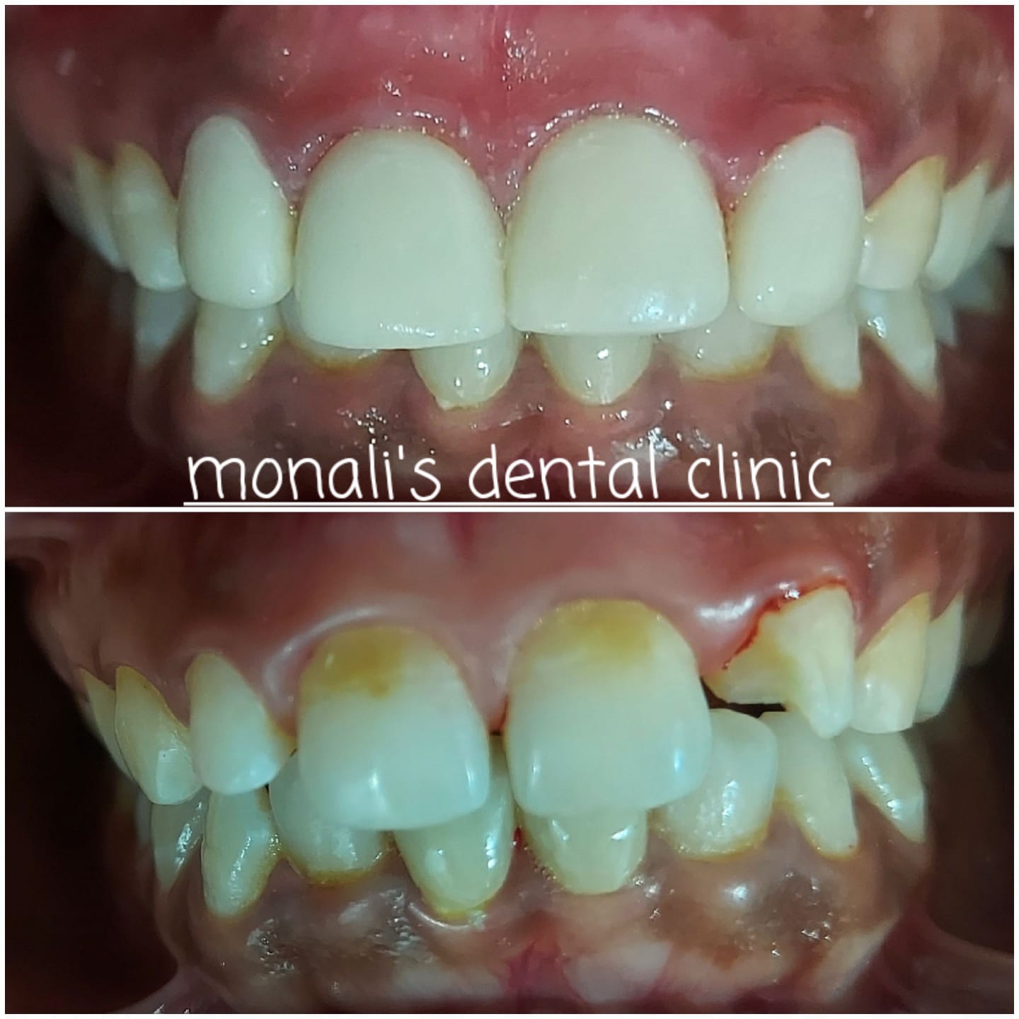 Photo from Monali_s Dental Clinic